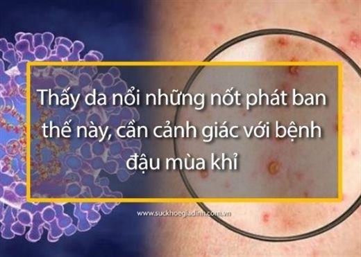 Cwin9000 phiên bản mới-Teramont-President-dau-xe